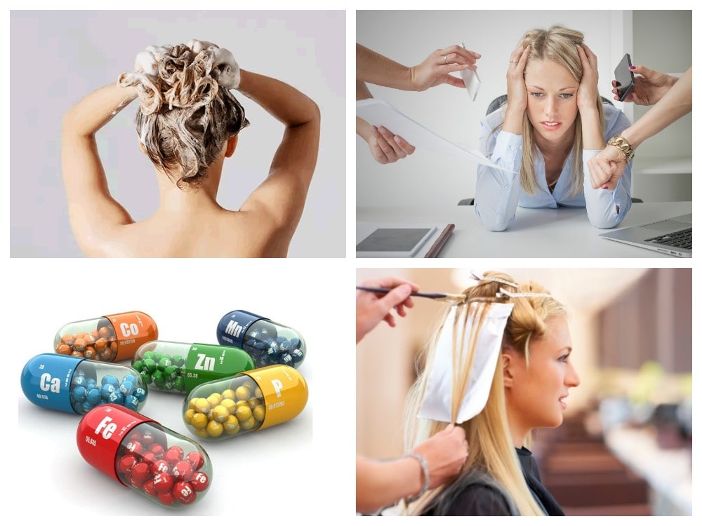 причины появления перхоти