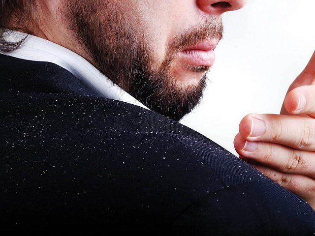 Как избавиться от перхоти мужчине