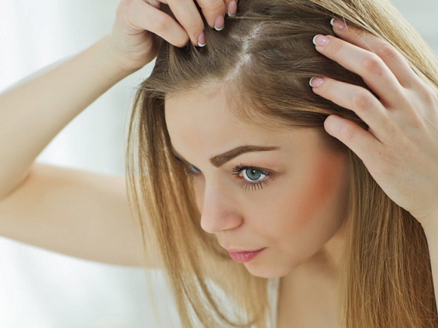 Причины перхоти у женщин